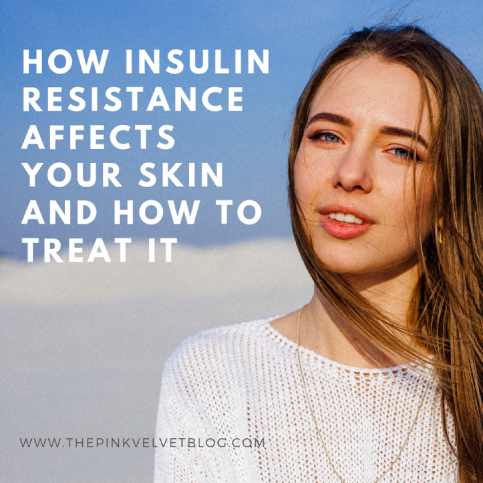 How Insulin Resistance Affects Your Skin and How to Treat